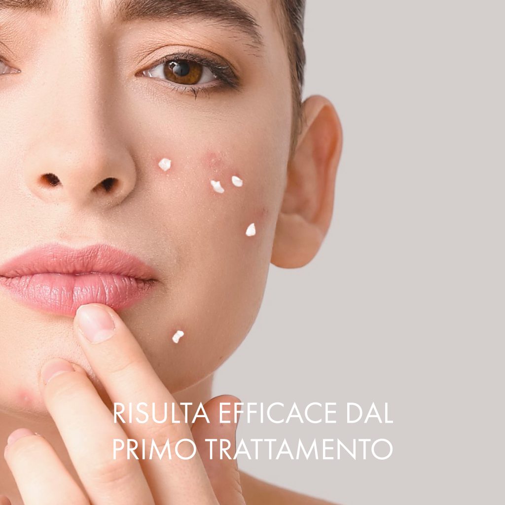 BALANCE TARGET Trattamento acne notturno